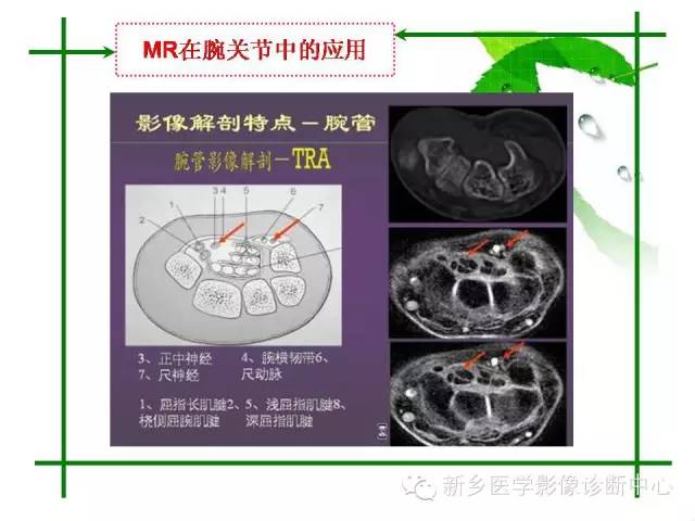 【PPT】CT和MR在骨与关节疾病的临床应用
