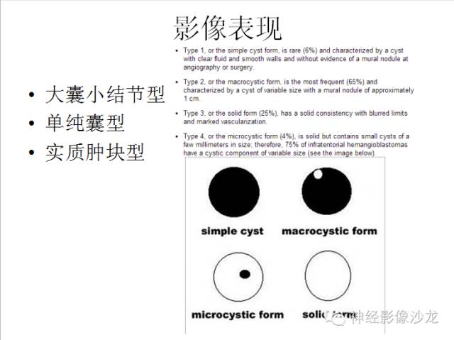 【病例】小脑血管母细胞瘤1例CT及MR影像表现