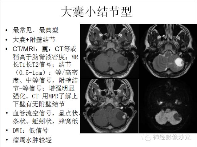 【病例】小脑血管母细胞瘤1例CT及MR影像表现