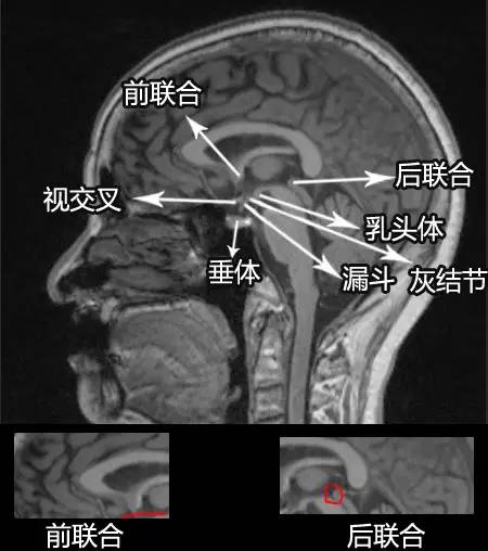 六步十图认识下丘脑，361度无死角