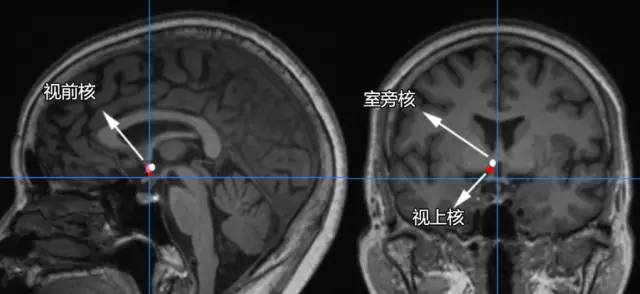 六步十图认识下丘脑,361度无死角 六步十图认识下丘脑,361度无死角