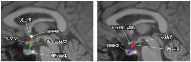 六步十图认识下丘脑,361度无死角 六步十图认识下丘脑,361度无死角