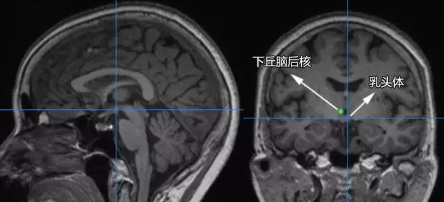 六步十图认识下丘脑,361度无死角 六步十图认识下丘脑,361度无死角