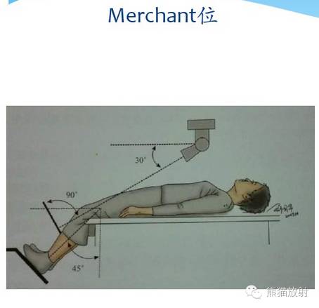 膝关节、胫腓骨——临床影像示例