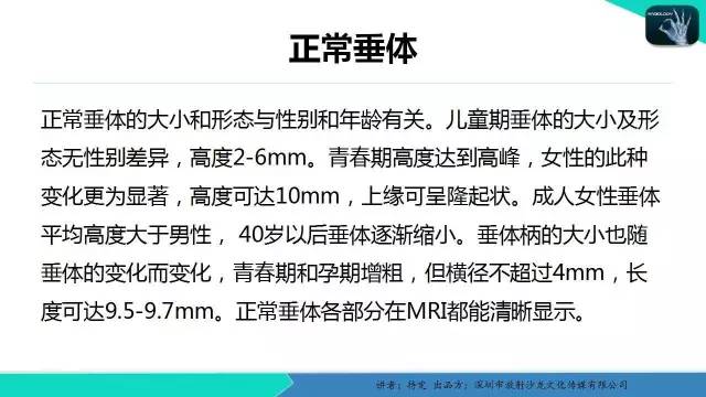 【病例】垂体柄阻断综合征1例MR影像表现