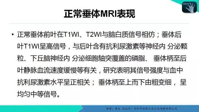 【病例】垂体柄阻断综合征1例MR影像表现