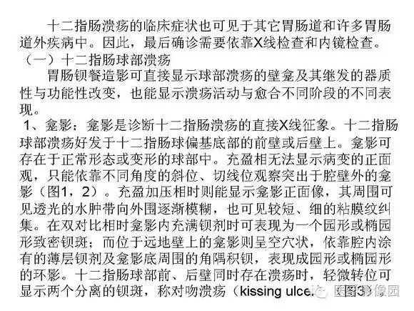 【PPT】十二指肠溃疡的影像学诊断