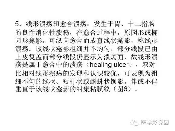 【PPT】十二指肠溃疡的影像学诊断