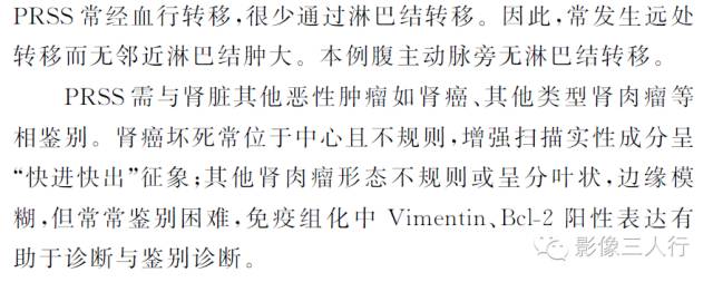 【病例】右肾滑膜肉瘤1例CT影像表现