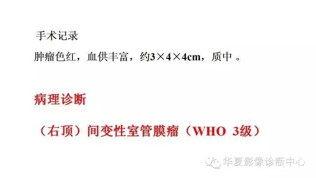 【病例】幕上脑实质室管膜瘤1例CT及MR