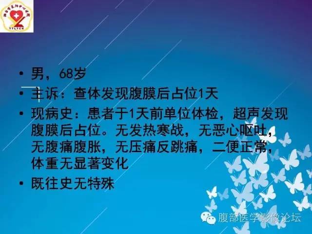 【病例】胃窦癌腹膜后淋巴结转移1例CT及MR