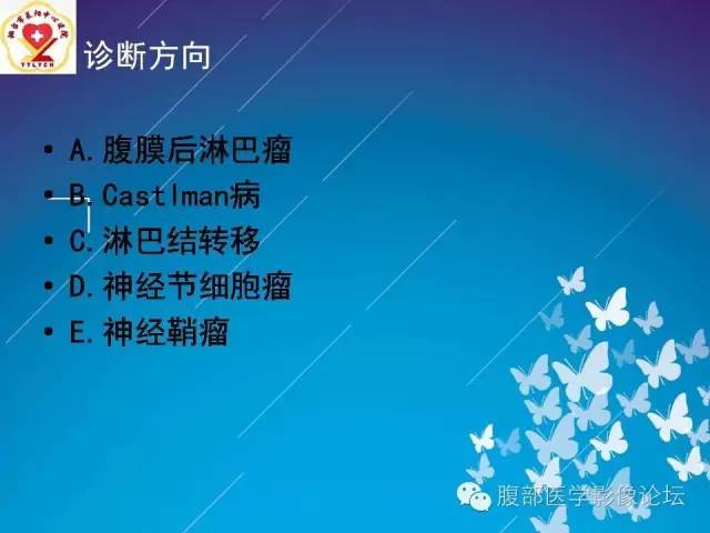 【病例】胃窦癌腹膜后淋巴结转移1例CT及MR