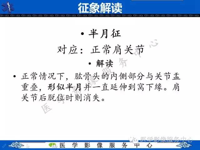【影像征象】半月征