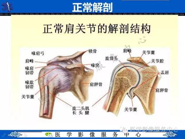 【影像征象】半月征