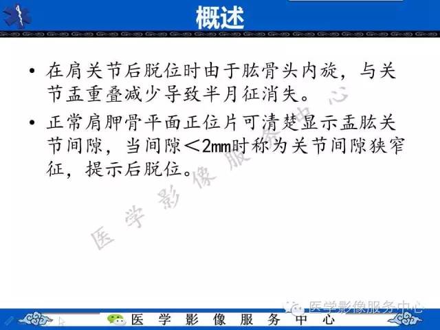 【影像征象】半月征