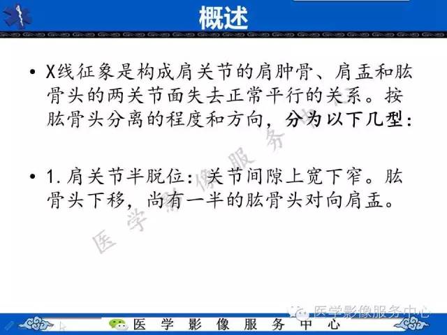 【影像征象】半月征