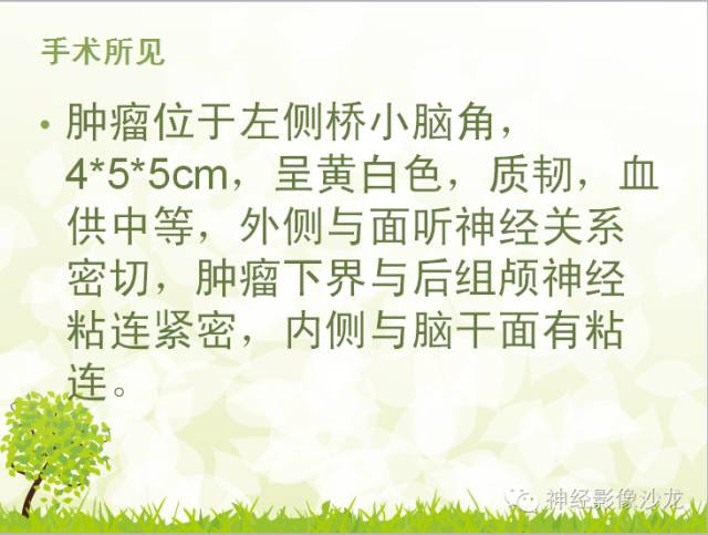【病例】左侧CPA孤立性纤维瘤1例