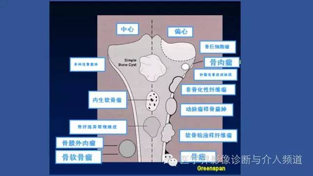 【PPT】识骨寻踪系列二——从病变的位置找到诊断线索