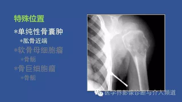 【PPT】识骨寻踪系列二——从病变的位置找到诊断线索