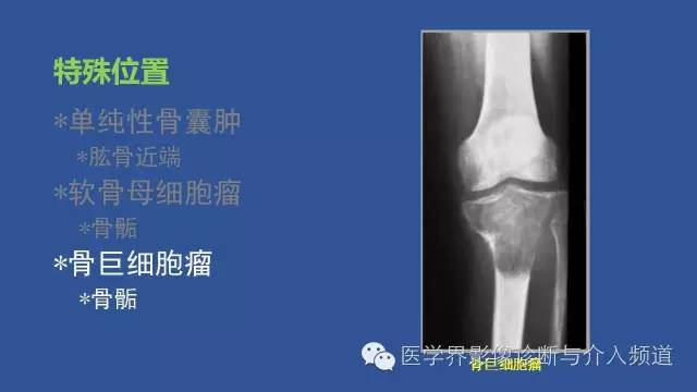 【PPT】识骨寻踪系列二——从病变的位置找到诊断线索