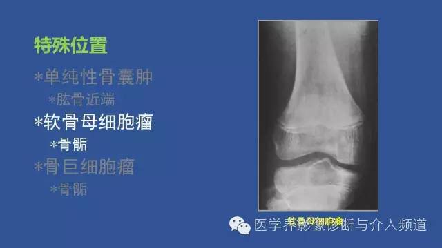 【PPT】识骨寻踪系列二——从病变的位置找到诊断线索