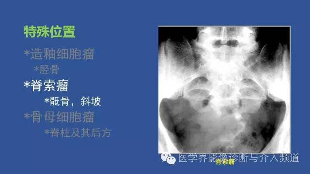 【PPT】识骨寻踪系列二——从病变的位置找到诊断线索