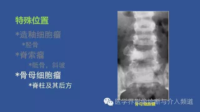 【PPT】识骨寻踪系列二——从病变的位置找到诊断线索