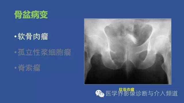 【PPT】识骨寻踪系列二——从病变的位置找到诊断线索