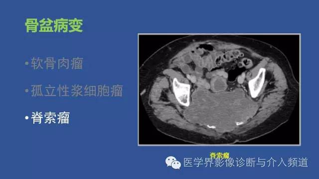 【PPT】识骨寻踪系列二——从病变的位置找到诊断线索