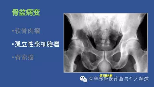 【PPT】识骨寻踪系列二——从病变的位置找到诊断线索