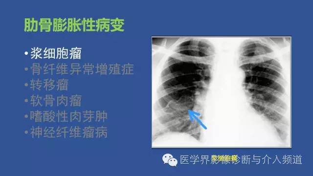 【PPT】识骨寻踪系列二——从病变的位置找到诊断线索