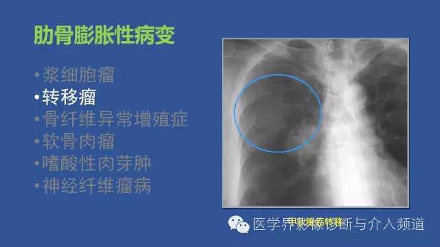 【PPT】识骨寻踪系列二——从病变的位置找到诊断线索