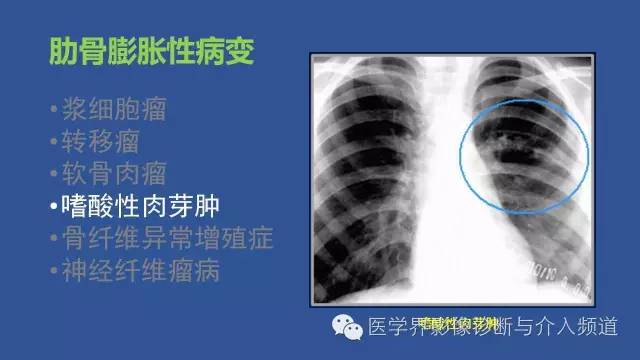 【PPT】识骨寻踪系列二——从病变的位置找到诊断线索