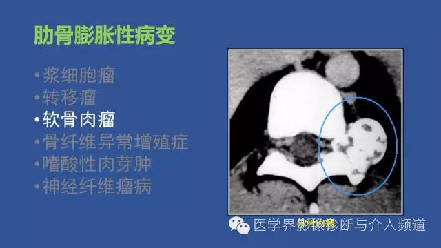 【PPT】识骨寻踪系列二——从病变的位置找到诊断线索