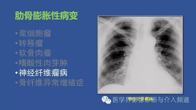 【PPT】识骨寻踪系列二——从病变的位置找到诊断线索