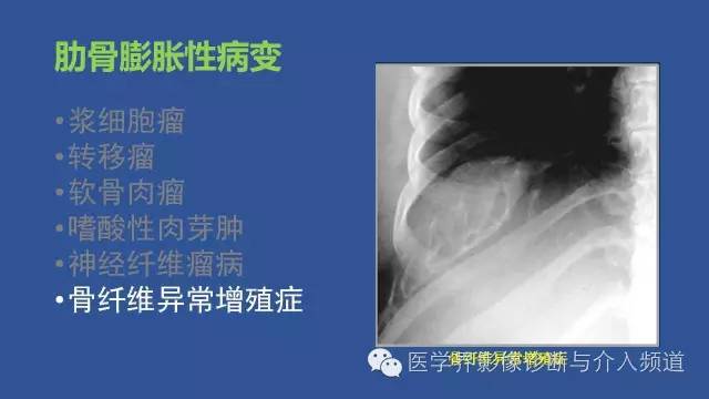 【PPT】识骨寻踪系列二——从病变的位置找到诊断线索
