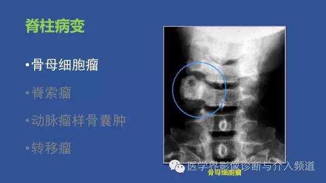 【PPT】识骨寻踪系列二——从病变的位置找到诊断线索