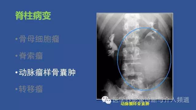 【PPT】识骨寻踪系列二——从病变的位置找到诊断线索