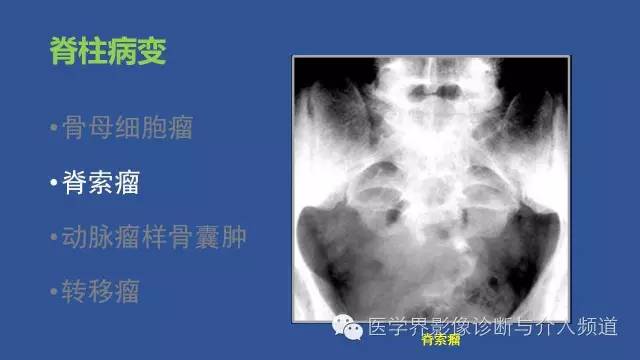 【PPT】识骨寻踪系列二——从病变的位置找到诊断线索