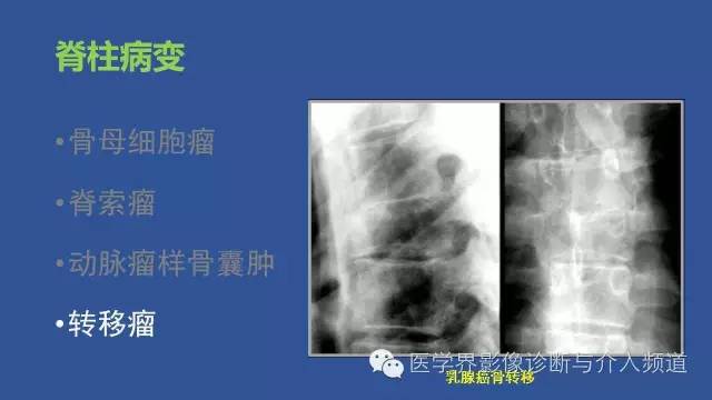 【PPT】识骨寻踪系列二——从病变的位置找到诊断线索