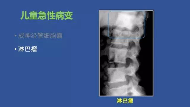 【PPT】识骨寻踪系列三——病变密度提示那些诊断线索
