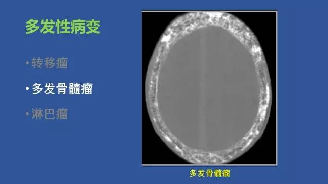 【PPT】识骨寻踪系列三——病变密度提示那些诊断线索