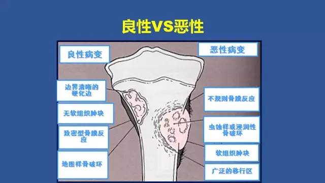 【PPT】识骨寻踪系列三——病变密度提示那些诊断线索
