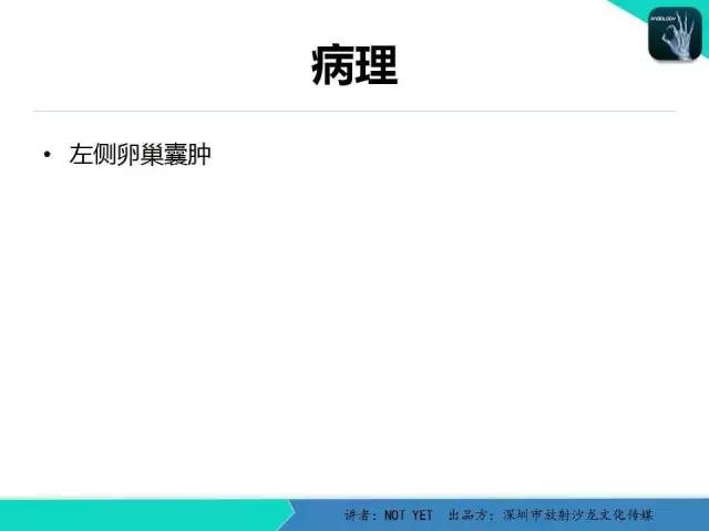【病例】新生儿卵巢病理性囊肿1例CT影像表现