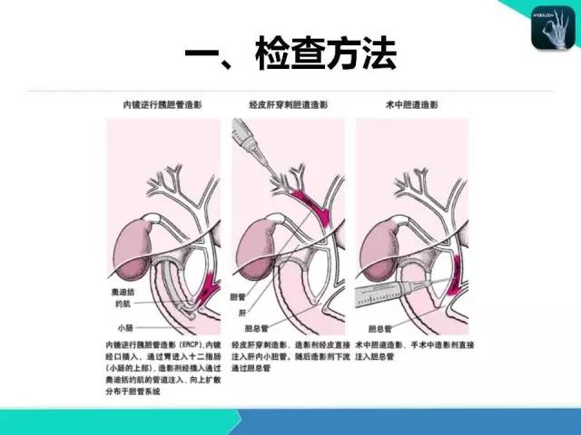 【PPT】胆道系统影像诊断