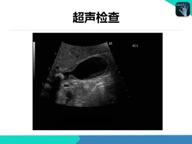 【PPT】胆道系统影像诊断