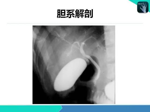 【PPT】胆道系统影像诊断