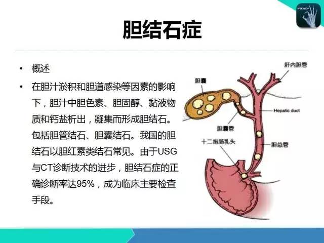 【PPT】胆道系统影像诊断