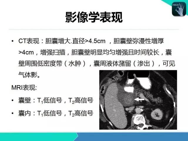 【PPT】胆道系统影像诊断