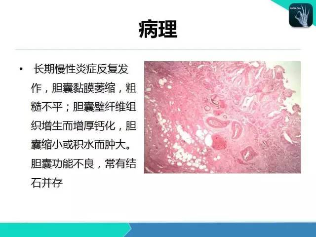 【PPT】胆道系统影像诊断